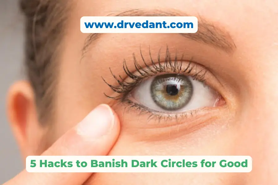 Dark Circle Tips | Best Skin Specialist Doctor Near Me