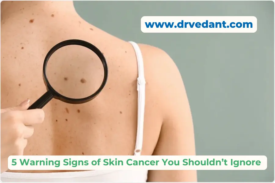 Signs of Skin Cancer | Skin Specialist Doctor Near Me