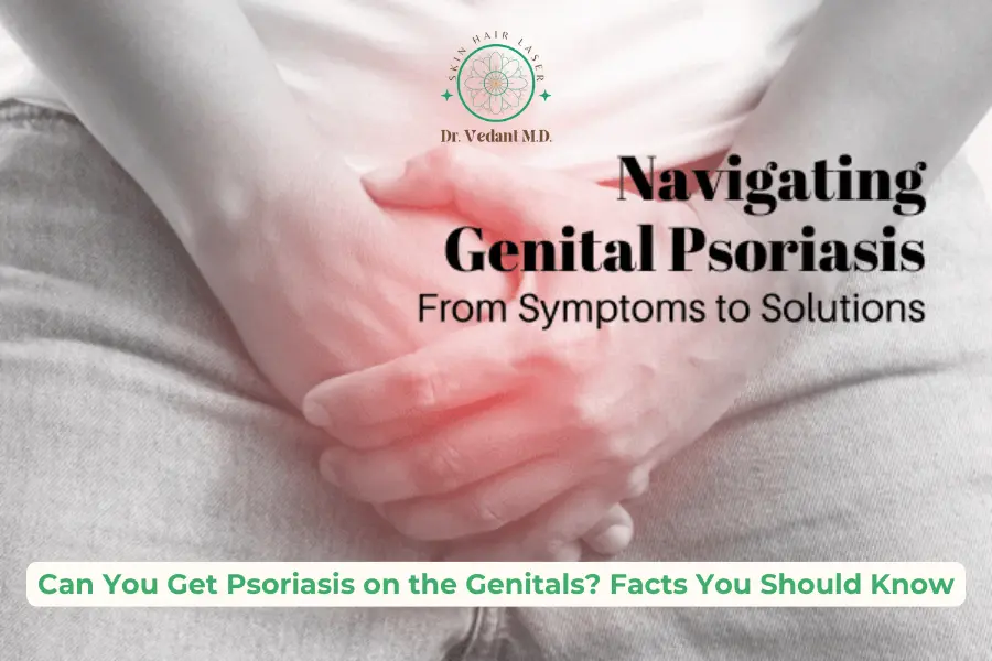 Genital Psoriasis Facts | Best Skin Specialist Near Me