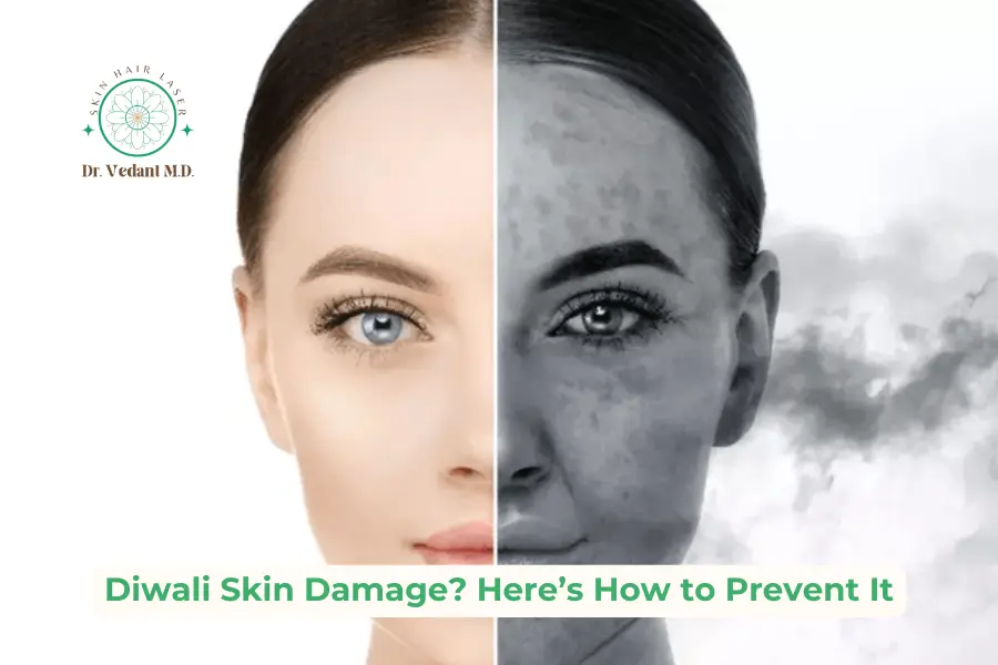 Diwali and Skin Damage | Skin Specialist Doctor Near Me