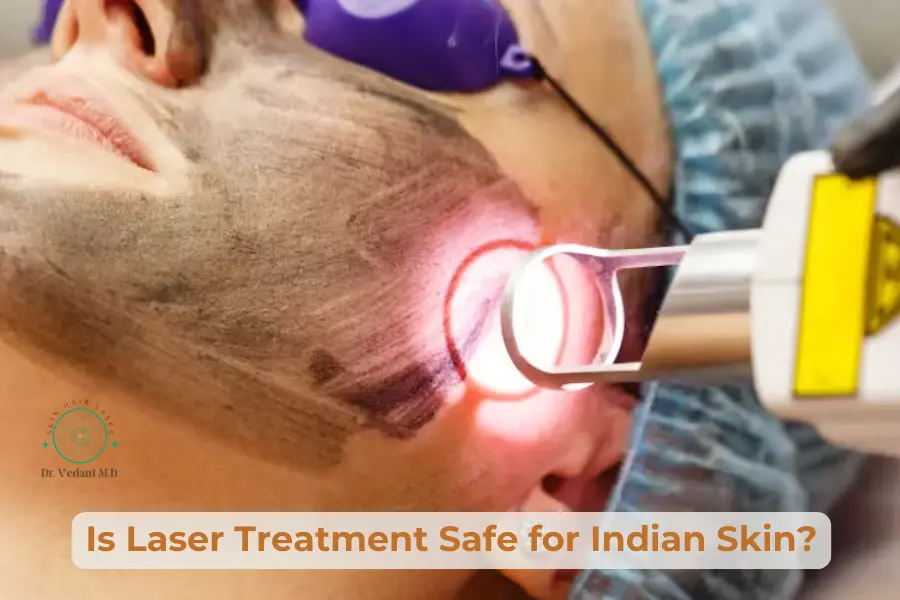Laser Treatment Safe for Indian Skin?|Dermatologist Near Me