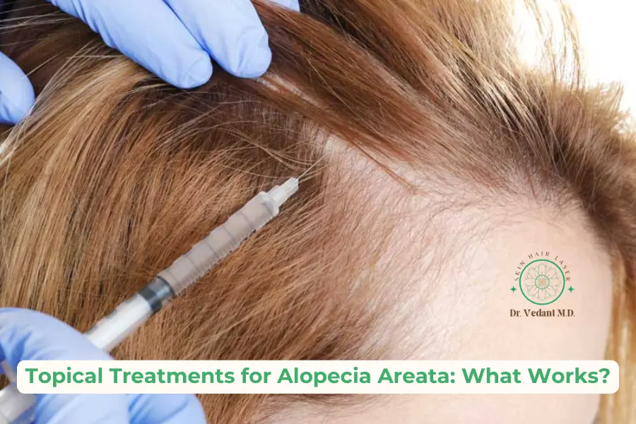 Alopecia Areata|Topical Treatment|Dermatologist in Ghatkopar